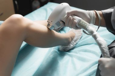 Kadın bir kozmetik uzmanının yakın çekimi güzel dişi bacaklarındaki kılları lazerle alıyor. Bacaklarda saç kesimi, klinikte lazer işlemi.