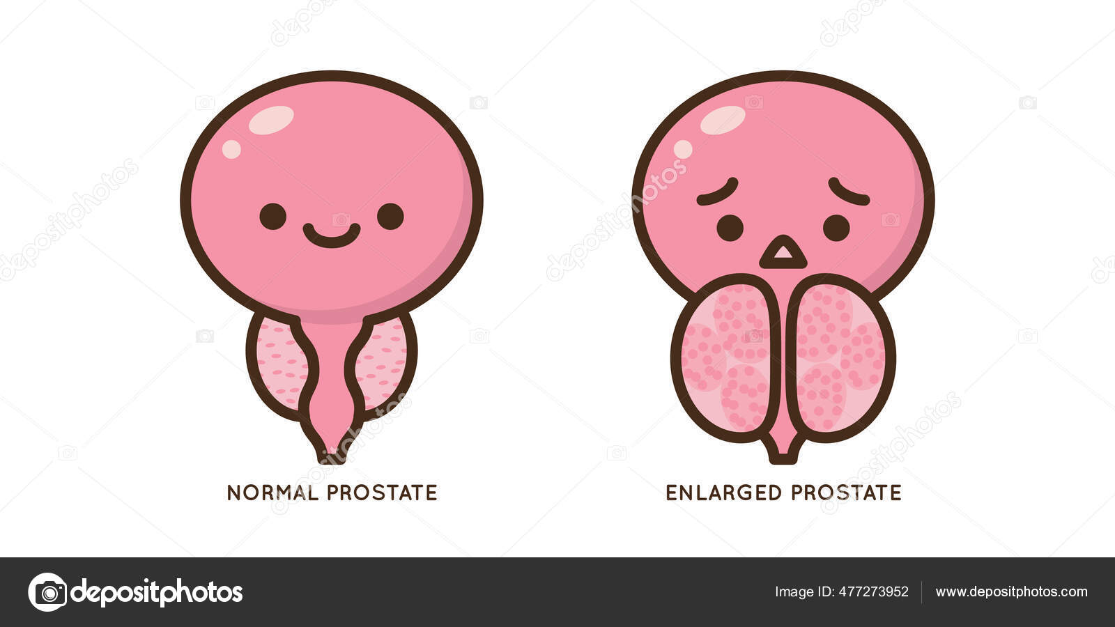 Cartoon Benign Prostate Vector Illustration Icon Character Male Urology Inflammation Stock Vector Image by ©manusa #477273952 Cartoon Benign Prostate Vector Illustration Icon Character Male Urology Inflammation Stock Vector Image by ©manusa #477273952