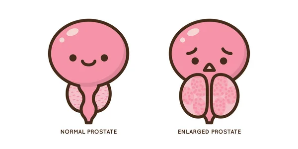 전립선 벡터의 예입니다 비뇨기과 염증성 질환의 아이콘 캐릭터 도표를 디자인 — 스톡 벡터