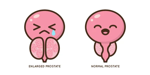 Desenhos Animados Benignos Próstata Ilustração Vetorial Caráter Ícone Doença Inflamação —  Vetores de Stock