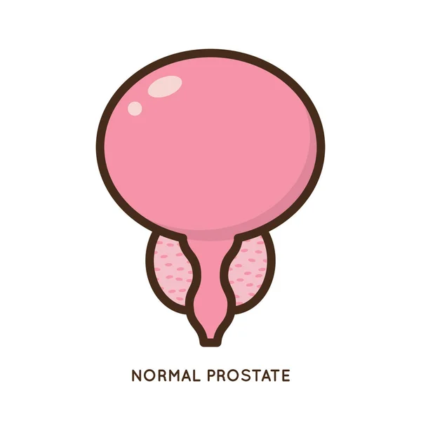 Desenhos Animados Benignos Próstata Ilustração Vetorial Caráter Ícone Doença Inflamação —  Vetores de Stock
