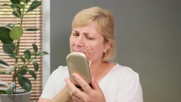 Blonde woman sitting at the table near the window with flower is fighting with annoying acne pain using cotton buds and heals it looking at the mirror. — Stock Video