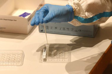 Avusturya 'da Corona antijen testi (Avrupa) 