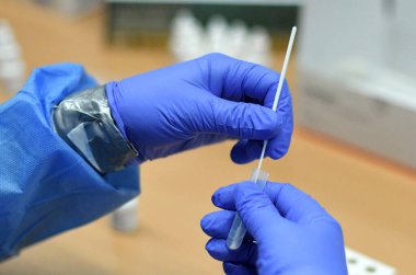 Avusturya 'da Corona antijen testi (Avrupa) 