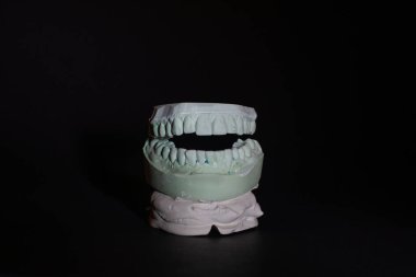 Siyah arkaplanda insan dişlerinin alçı taşı modeli.