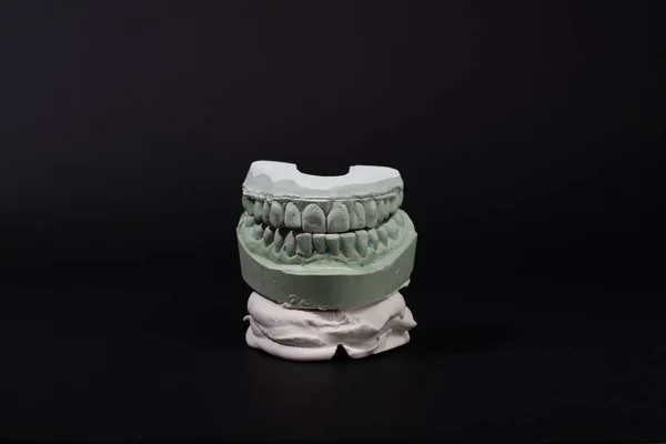 Gypsum Dental model of human teeth on black background. — Stock Photo, Image