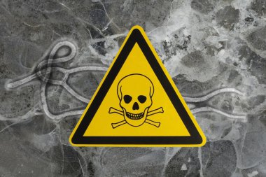 Ebola virüsü