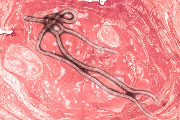 Vírus do ébola — Fotografia de Stock