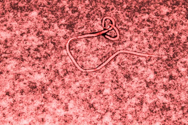 埃博拉病毒 — 图库照片