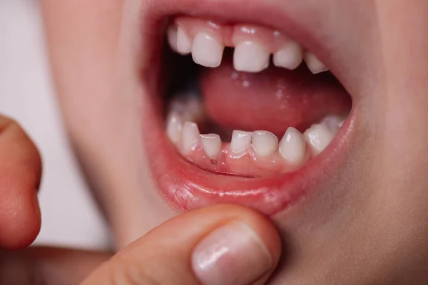 Dents De Bebe Tombent Images Libres De Droit Photos De Dents De Bebe Tombent Depositphotos