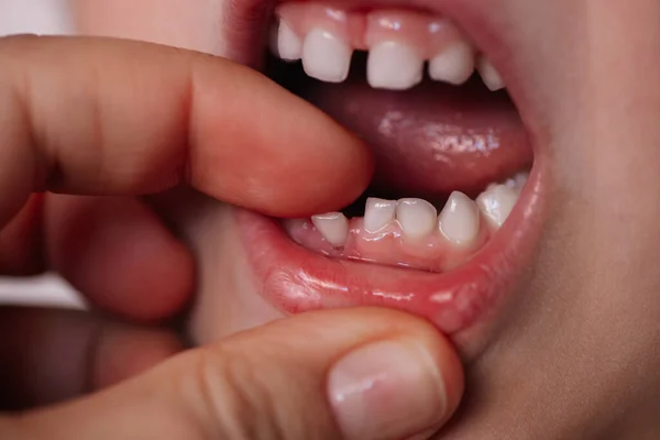 Dents De Bebe Tombent Images Libres De Droit Photos De Dents De Bebe Tombent Depositphotos