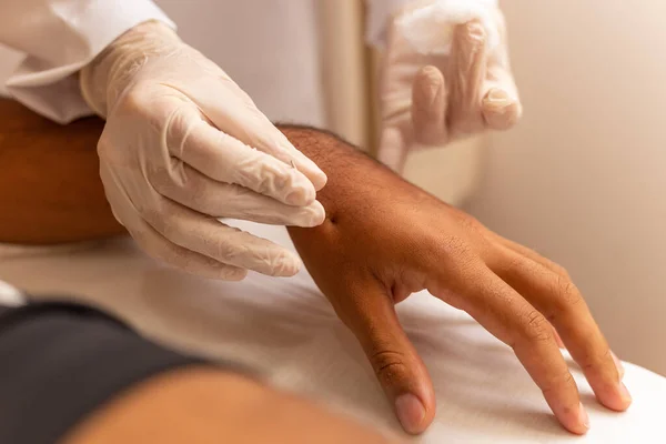 Terapeuta Aplicando Agulhas Acupuntura Mão Paciente — Fotografia de Stock