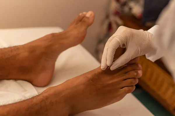 Hands Therapist Gloves Putting Acupuncture Needle Patient Foot — Stock Photo, Image