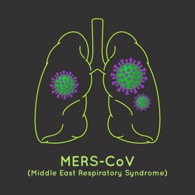 Mers-Cov(Middle East respiratory syndrome coronavirus) görüntü hasta