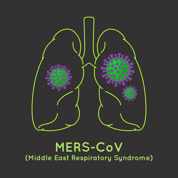 Nemocný Mers-Cov(Middle East respiratory syndrome coronavirus) obrázek — Stockový vektor