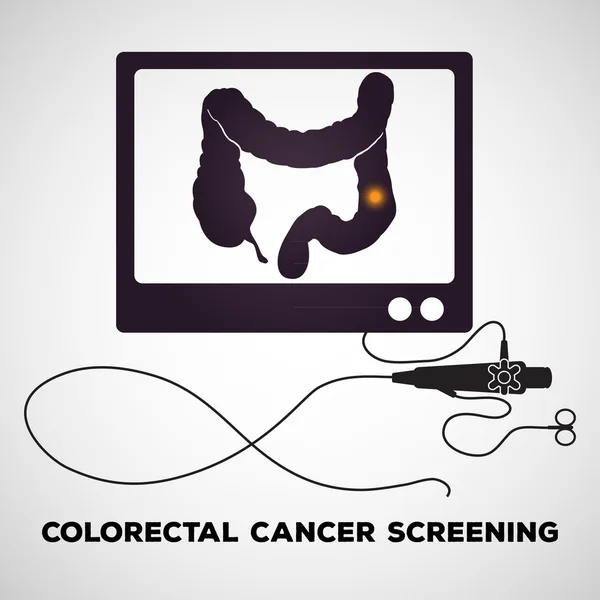 Procedimiento de colonoscopia utilizado para detectar enfermedades del colon — Vector de stock