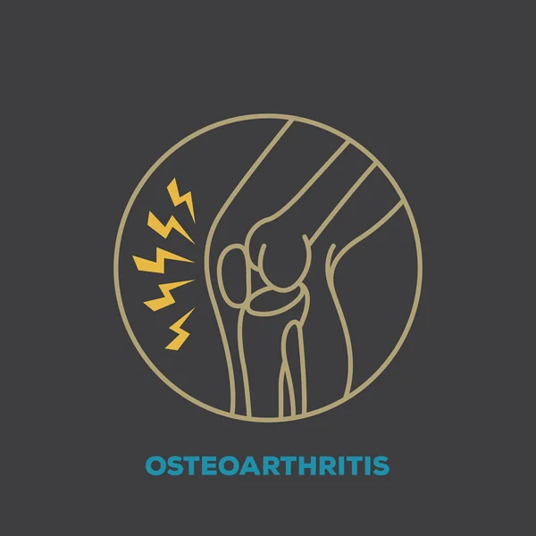 Osteoartritida — Stockový vektor