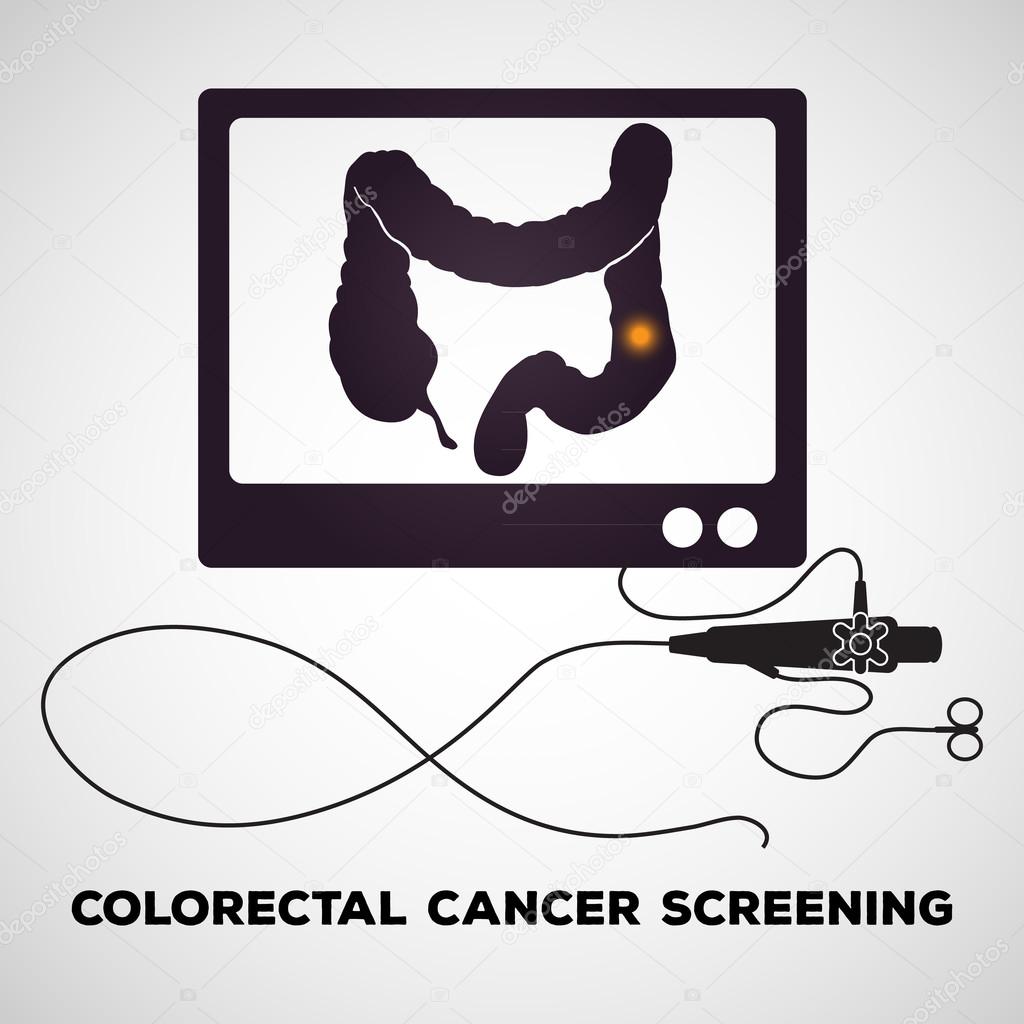 Colonoscopy procedure used for screening colon diseases