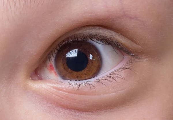 Κοντινό Πλάνο Δύο Ερεθισμένων Κόκκινων Ματιών Αίματος — Φωτογραφία Αρχείου