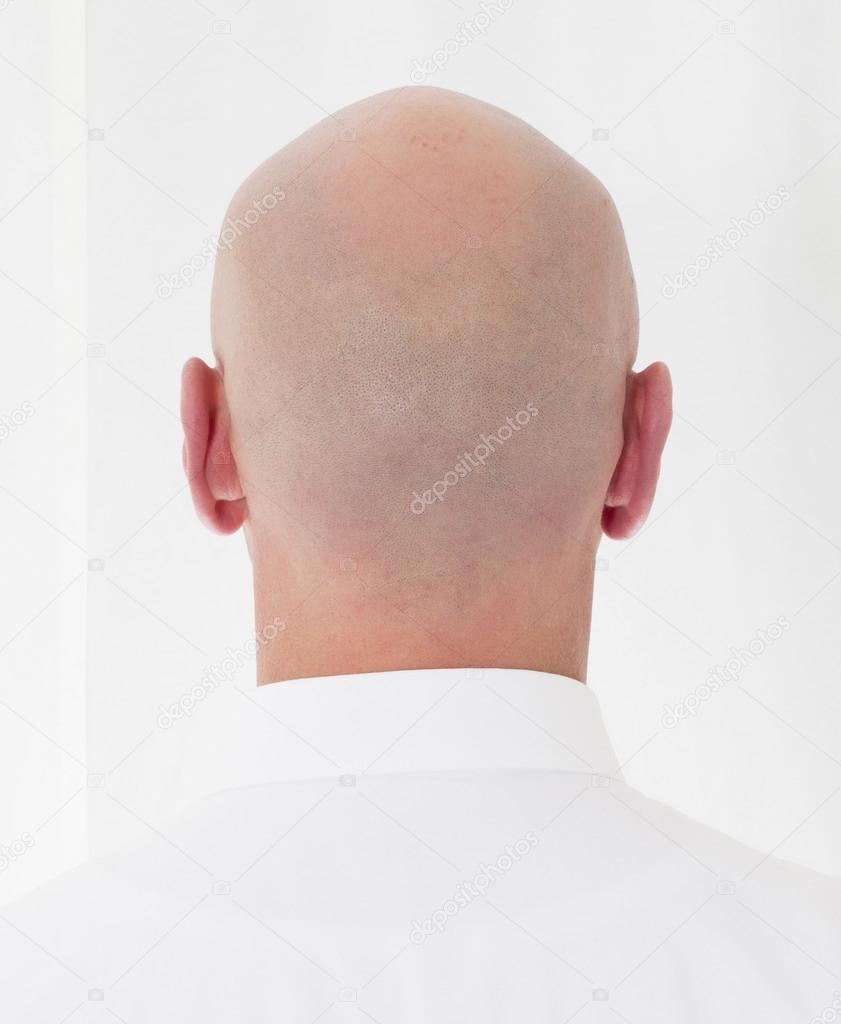 back of a bald head