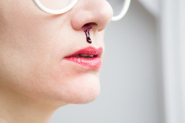 burun kanaması kadınla closeup