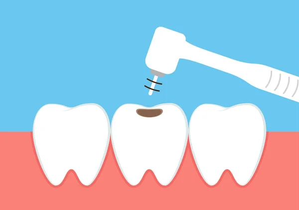 Tänder Tecknad Vektor Tandläkarutrustningens Vektor Tandhålan — Stock vektor