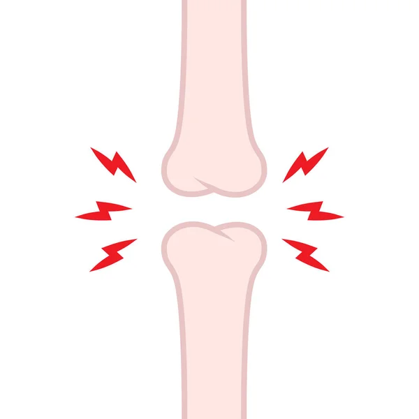 Diz kemiği sorunları. Kemik çizgi film vektörü. 
