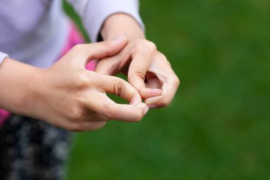 Hipermobil işaret parmaklı Childs elleri. Bağ dokusu bozukluğu. Kapatın. Seçici odak.