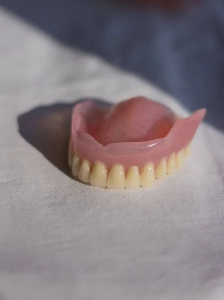 Prótesis Extraíbles Para Paciente Odontología —  Fotos de Stock