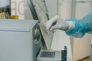 Genç bilim adamı, tıp çalışanı, teknoloji ya da lisansüstü öğrencisi modern biyoloji laboratuvarında çalışıyor. Tıbbi ekipman. Kan testi.