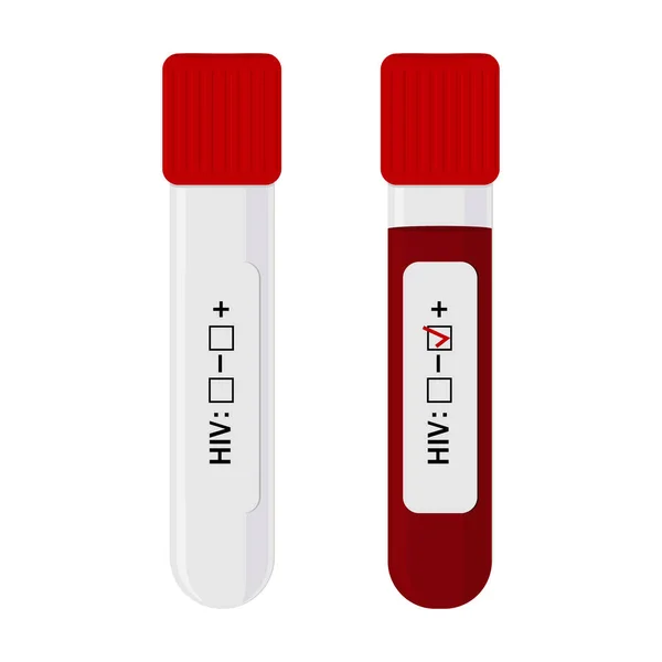 HivとAidsのための空の試験管と血液検査管陽性検査 白の背景にフラットスタイルで色分離ベクトルイラスト バナー ポスター トレーニング チュートリアル クリップ — ストックベクタ