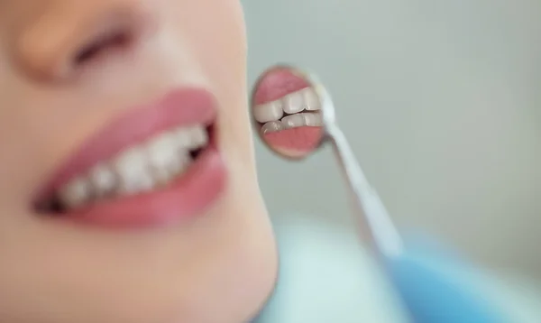 Zęby zdrowe kobiety i lustrem usta dentysta z kliniki szary tło, Europejska uroda — Zdjęcie stockowe