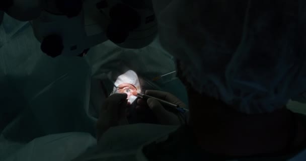 Коррекция зрения. Хирург во время операции на глазу в операционной. Анестезия перед офтальмологической операцией. — стоковое видео