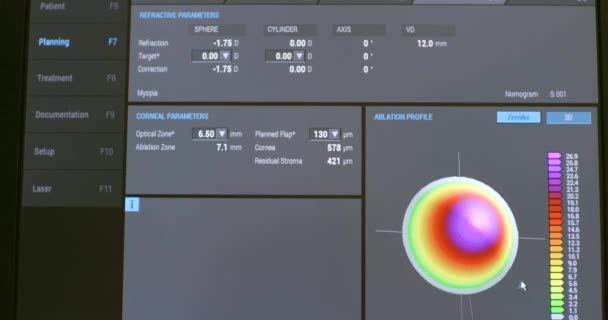 Informacje na ekranie maszyny do laserowej ekscytacji podczas operacji laserowej korekcji wzroku. Monitorowanie danych technicznych i odczytów przyrządów podczas eksploatacji — Wideo stockowe