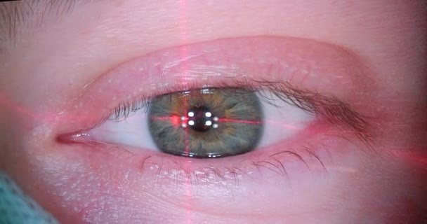 Close-up view eye on the monitor excimer laser machine screen during ophthalmic laser vision correction operation. — Stock Video