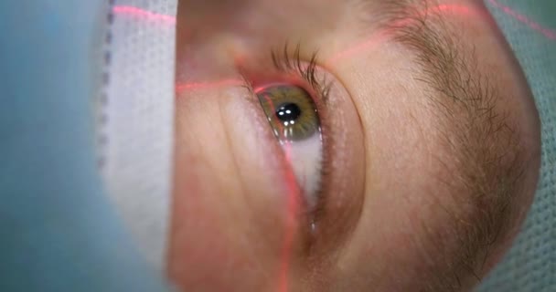 Lézeres látásjavítás. Közelkép a betegek szeméről a műtőasztalon a szemészeti beavatkozás előtt a műtőben. — Stock videók
