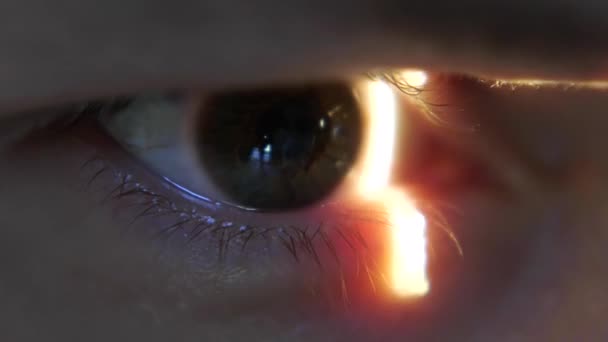 Крупним планом у пацієнтів око, освітлене лазерним променем під час офтальмологічного огляду з лампою в клініці медичної офтальмології . — стокове відео