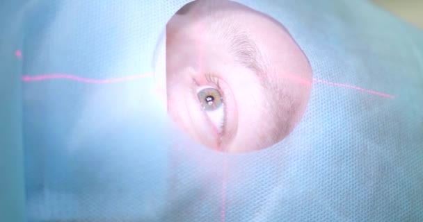 Лазерная коррекция зрения, подготовка к операции на глазах. Крупный план пациента под стерильным плащом на операционном столе в операционной — стоковое видео