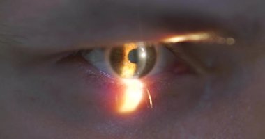 Tıbbi oftalmoloji kliniğinde lazer ve yarık lamba kullanılarak yapılan muayenede gözlerinizi kapatın.