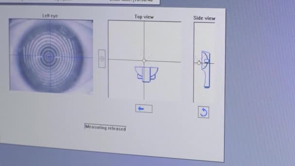 Screen view digitale biometrische en tomografie van het oog tijdens medisch onderzoek in oogheelkundige kliniek — Stockvideo