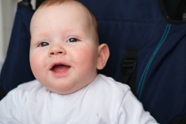 Çocuğun alerjisi ve ilk dişleri var. Bebek arabasında oturan bir çocuğun portresi.