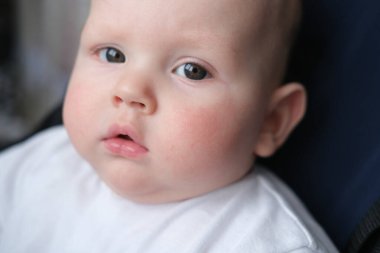 Çocuğun alerjisi ve ilk dişleri var. Bebek arabasında oturan bir çocuğun portresi.