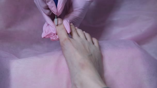 足のペディキュアを閉じます。医者の小児科医はハードウェアの絵を描く。爪の治療と病理学の概念. — ストック動画