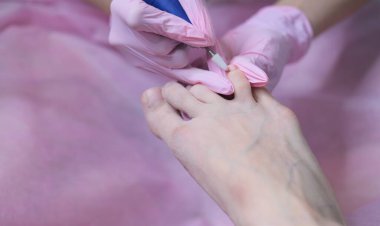 Ortopedi cerrahisi randevusunda olan bir hasta. Elektrikli makinede profesyonel donanım pedikürü. Özel bir elektrikli aletle ayak soymak. 