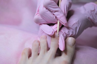 Ortopedi cerrahisi randevusunda olan bir hasta. Elektrikli makinede profesyonel donanım pedikürü. Özel bir elektrikli aletle ayak soymak. 