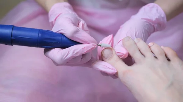 Een Patiënt Die Een Medische Pedicure Ondergaat Bij Een Orthopedische — Stockfoto