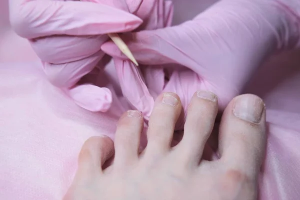 Patient Undergoing Medical Pedicure Procedure Orthopedic Surgeon Appointment Professional Hardware — Stock Photo, Image