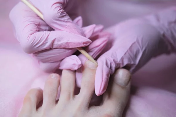 Paciente Submetido Procedimento Pedicura Médica Consulta Cirurgião Ortopédico Pedicure Hardware — Fotografia de Stock