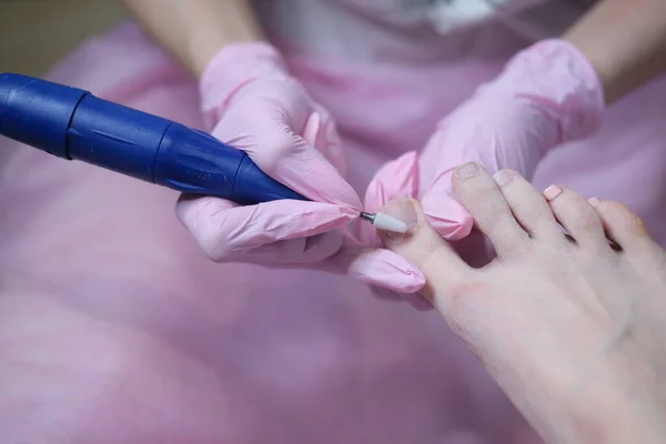 Paciente Submetido Procedimento Pedicura Médica Consulta Cirurgião Ortopédico Pedicure Hardware — Fotografia de Stock