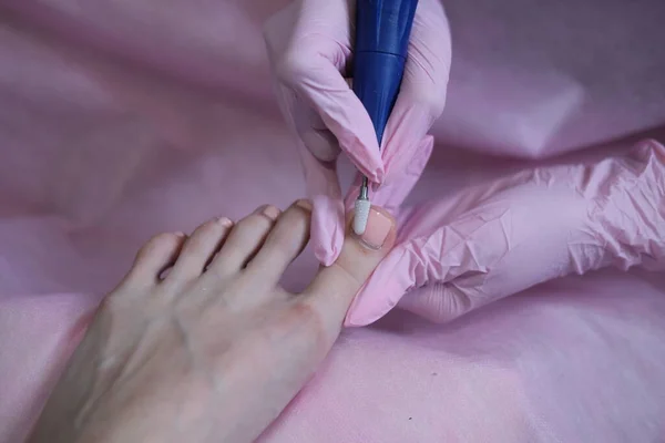 在骨科医生的预约下正在接受手术的病人 电机上的专业硬脚修补术 用特殊的电气设备剥落脚 — 图库照片